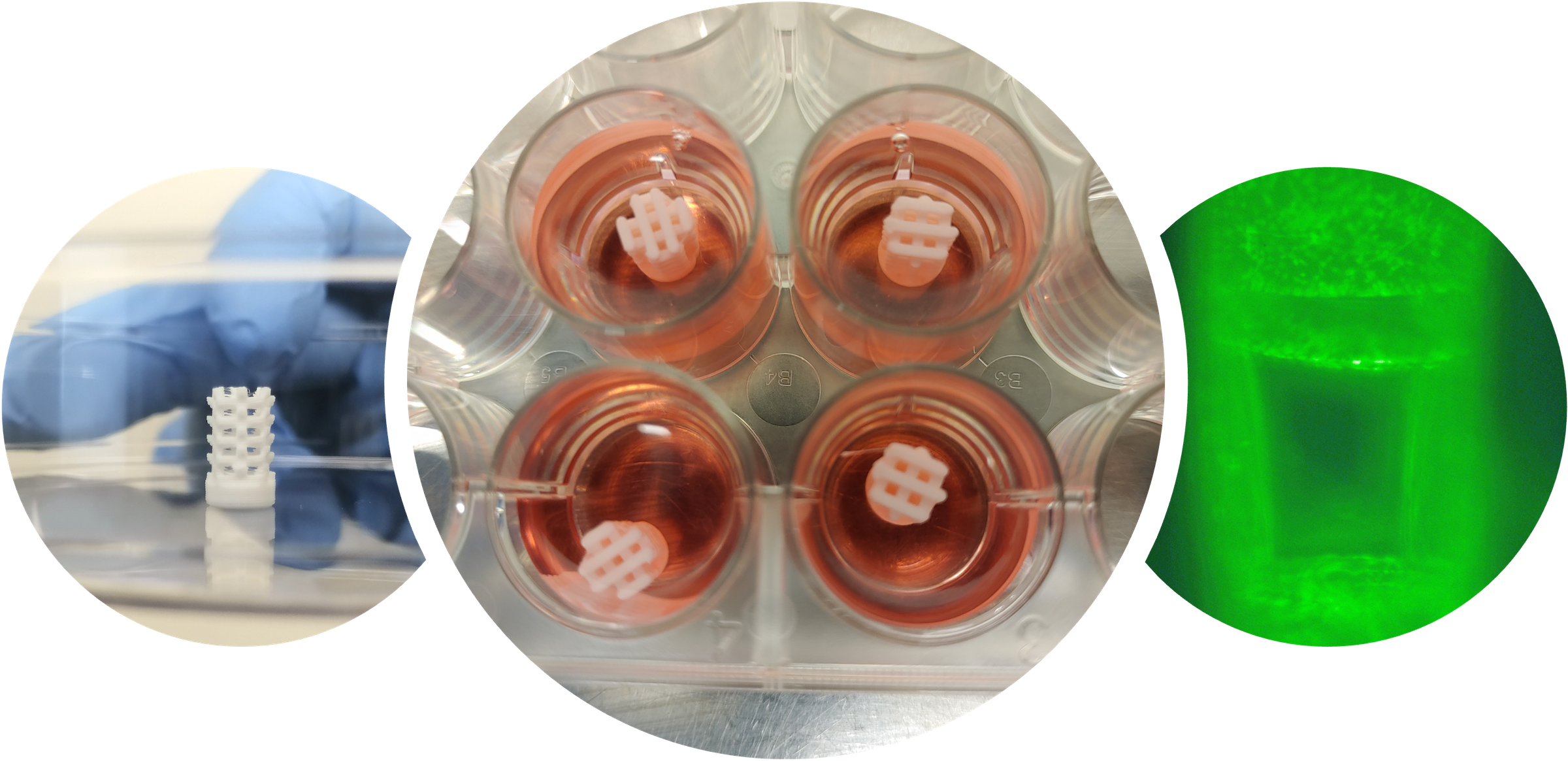 3D Printing of Bone Substitutes Based on Vat Photopolymerization Processes: A Systematic Review