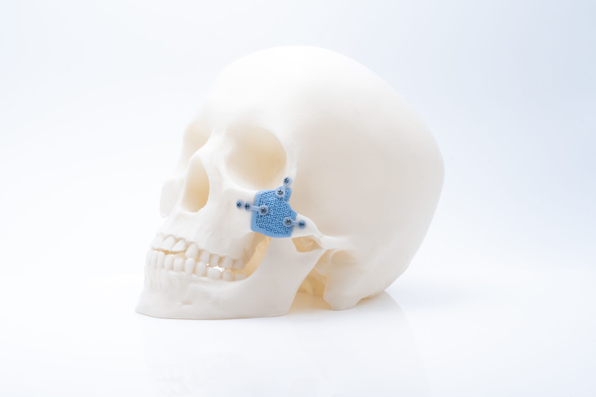 Lithoz on pioneering medical applications of 3D printed ceramics