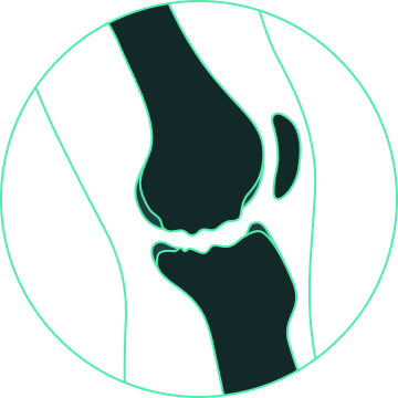 prosthesis design for osteochondral defects